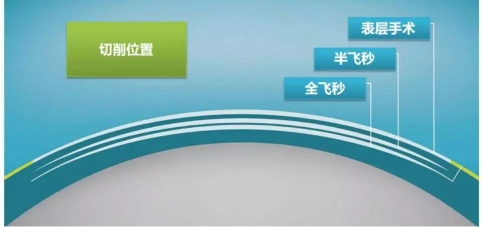 全飞秒、半飞秒和表层手术对比详解