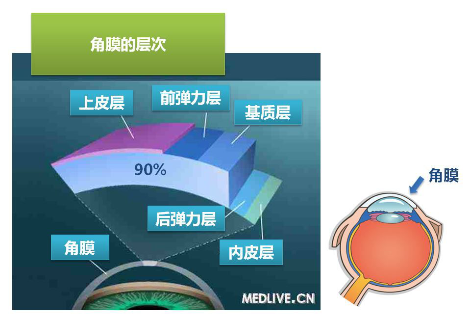 全飞秒、半飞秒和表层手术对比详解