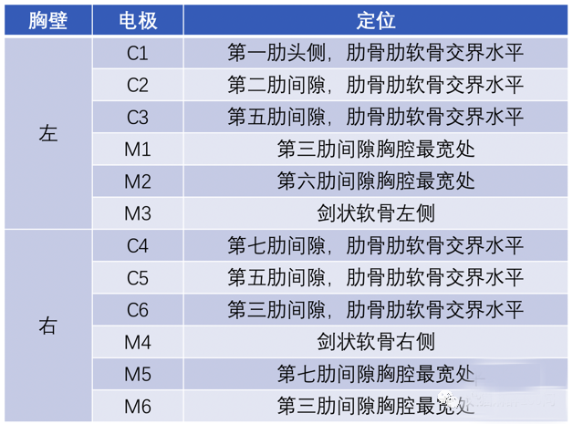 心电图滤波怎么选择【知跃干货】心电图基本示例_https://www.jmylbn.com_新闻资讯_第10张