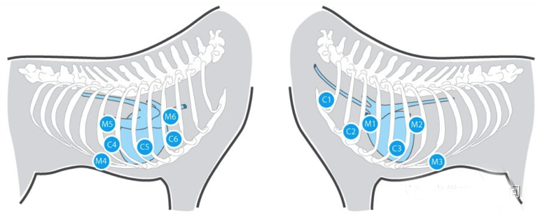 心电图滤波怎么选择【知跃干货】心电图基本示例_https://www.jmylbn.com_新闻资讯_第9张