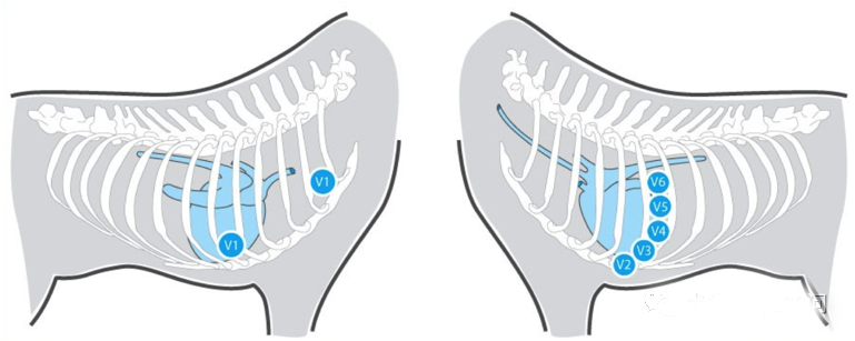 心电图滤波怎么选择【知跃干货】心电图基本示例_https://www.jmylbn.com_新闻资讯_第11张