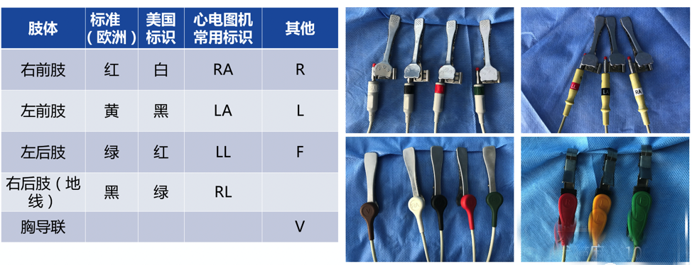 心电图滤波怎么选择【知跃干货】心电图基本示例_https://www.jmylbn.com_新闻资讯_第12张