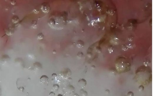 瓷器破泡里找到臭干黑或黄水斑，就可判定为古瓷了