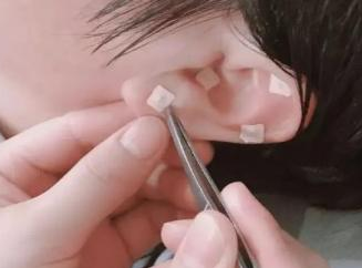 南川妇幼保健院怎么样医院动态丨冬病冬防，南川区妇幼保健院中医科“三九贴” 来啦！_https://www.jmylbn.com_新闻资讯_第26张