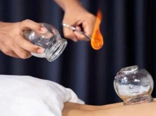 南川妇幼保健院怎么样医院动态丨冬病冬防，南川区妇幼保健院中医科“三九贴” 来啦！_https://www.jmylbn.com_新闻资讯_第24张