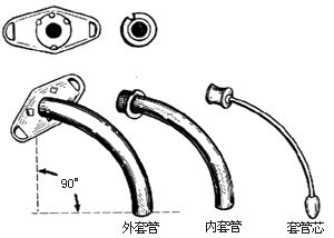 气管套管怎么换药【康复科普】气管切开患者的居家护理之三避免意外脱管_https://www.jmylbn.com_新闻资讯_第3张