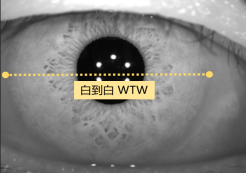 眼科生物测量仪怎么看科普：如何快速看懂生物测量仪检查报告？_https://www.jmylbn.com_新闻资讯_第7张