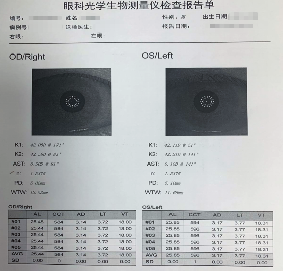 眼科生物测量仪怎么看轻松看懂眼科光学生物测量仪报告单_https://www.jmylbn.com_新闻资讯_第3张