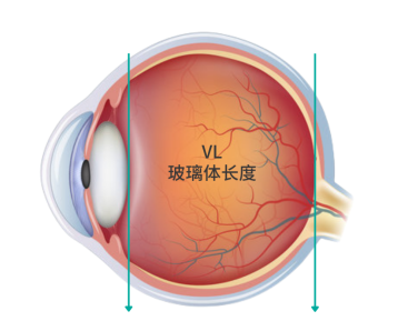 眼科生物测量仪怎么看轻松看懂眼科光学生物测量仪报告单_https://www.jmylbn.com_新闻资讯_第14张
