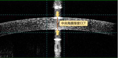 眼科生物测量仪怎么看科普：如何快速看懂生物测量仪检查报告？_https://www.jmylbn.com_新闻资讯_第10张