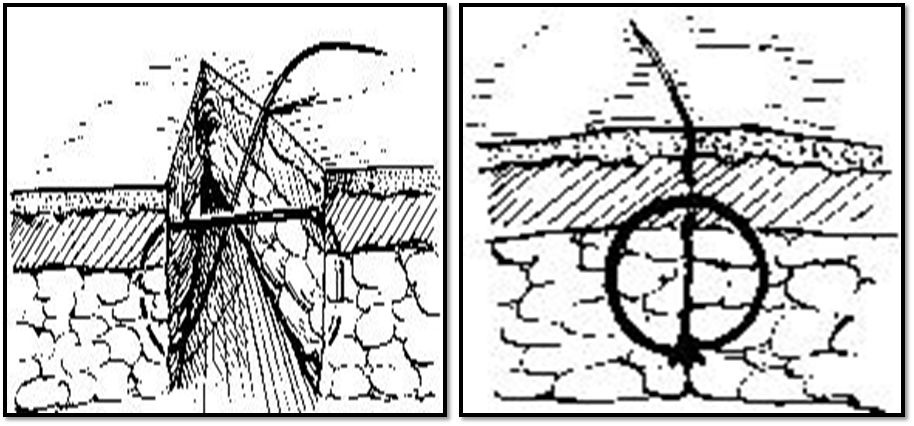 缝合怎么换药外科“清创+缝合+换药”，这些技能你都Get了吗？_https://www.jmylbn.com_新闻资讯_第5张