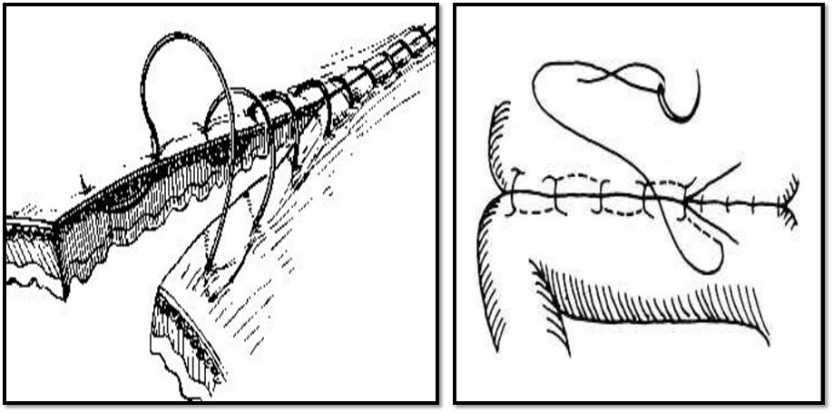 缝合怎么换药外科“清创+缝合+换药”，这些技能你都Get了吗？_https://www.jmylbn.com_新闻资讯_第7张