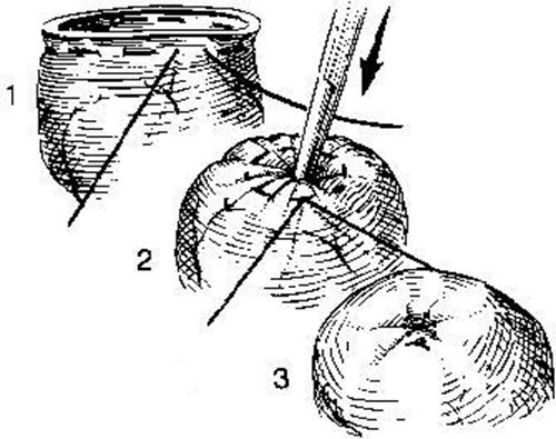 缝合怎么换药外科“清创+缝合+换药”，这些技能你都Get了吗？_https://www.jmylbn.com_新闻资讯_第9张