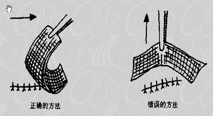 缝合怎么换药外科“清创+缝合+换药”，这些技能你都Get了吗？_https://www.jmylbn.com_新闻资讯_第15张