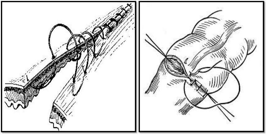 缝合怎么换药外科“清创+缝合+换药”，这些技能你都Get了吗？_https://www.jmylbn.com_新闻资讯_第8张