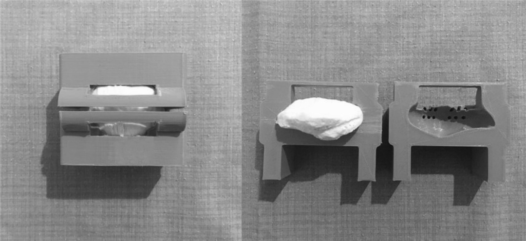 Illustration 2 for 骨科必读：优化Weber改良张力带！K氏针1.8mm精准定位，如何防止2mm移位，彻底终结髌骨骨折难题？