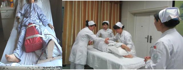 什么病忌用翻身床为什么临床必会 ｜ 15种骨科常见病的最佳术后体位+功能锻炼_https://www.jmylbn.com_新闻资讯_第17张