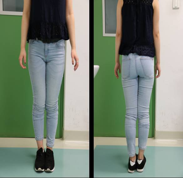 专题教程髋关节置换术后的不稳