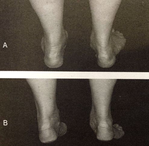 怎么评估病人肌力“肩 髋 膝 踝” 4大关节体格检查，干货速取！_https://www.jmylbn.com_新闻资讯_第55张