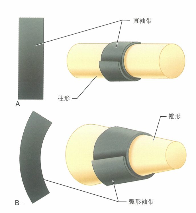 手术怎么止血骨科手术止血带使用需要注意的细节，你都掌握了吗？_https://www.jmylbn.com_新闻资讯_第5张