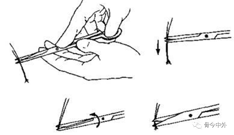 缝合怎么换药外科“清创+缝合+换药”，这些技能你都Get了吗？_https://www.jmylbn.com_新闻资讯_第13张