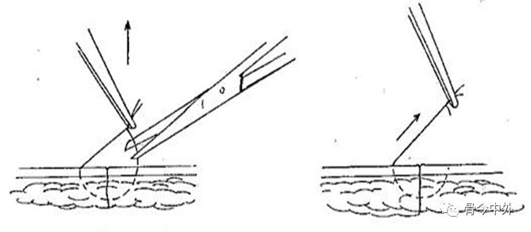 缝合怎么换药外科“清创+缝合+换药”，这些技能你都Get了吗？_https://www.jmylbn.com_新闻资讯_第14张