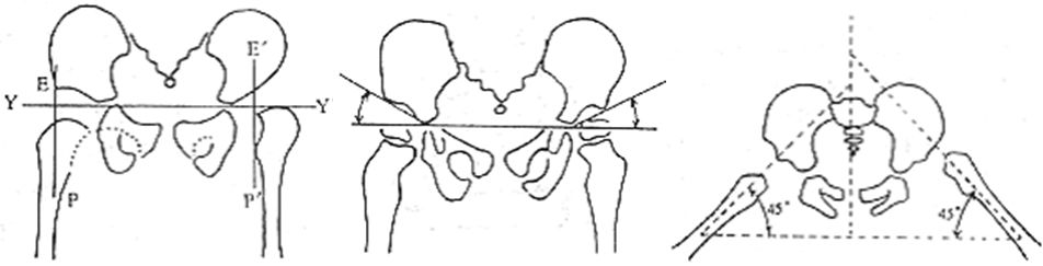 39种常见骨科疾病的X线表现，看你认识几种？