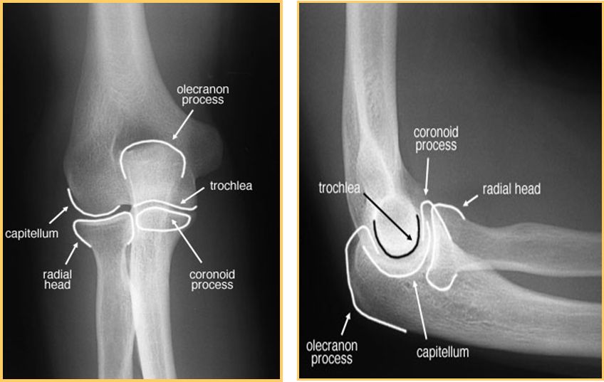 39种常见骨科疾病的X线表现，看你认识几种？