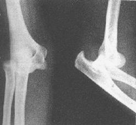 疼痛科怎么理疗疼痛科医生、康复理疗科医生、针刀针灸医生应掌握的常见骨科疾病X光片_https://www.jmylbn.com_新闻资讯_第10张