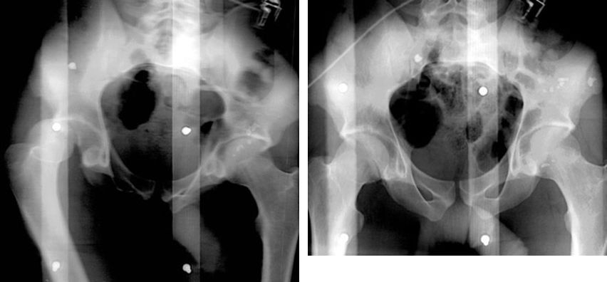 疼痛科怎么理疗疼痛科医生、康复理疗科医生、针刀针灸医生应掌握的常见骨科疾病X光片_https://www.jmylbn.com_新闻资讯_第48张