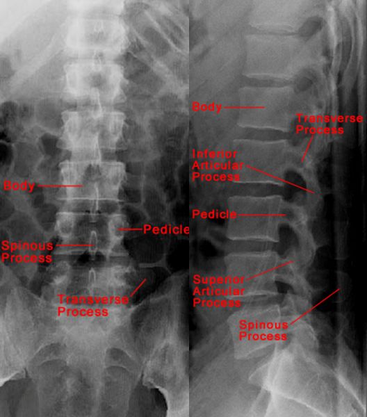 39种常见骨科疾病的X线表现，看你认识几种？