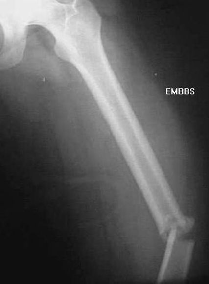 疼痛科怎么理疗疼痛科医生、康复理疗科医生、针刀针灸医生应掌握的常见骨科疾病X光片_https://www.jmylbn.com_新闻资讯_第32张