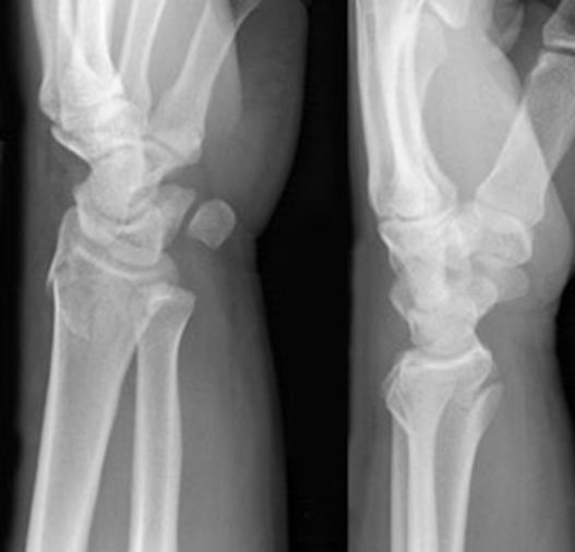 疼痛科怎么理疗疼痛科医生、康复理疗科医生、针刀针灸医生应掌握的常见骨科疾病X光片_https://www.jmylbn.com_新闻资讯_第21张