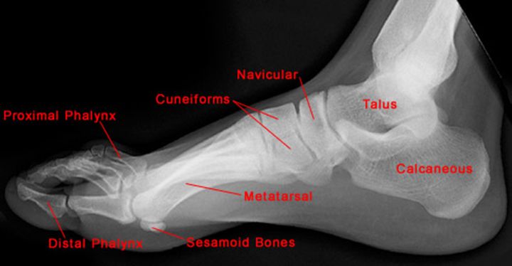 疼痛科怎么理疗疼痛科医生、康复理疗科医生、针刀针灸医生应掌握的常见骨科疾病X光片_https://www.jmylbn.com_新闻资讯_第42张