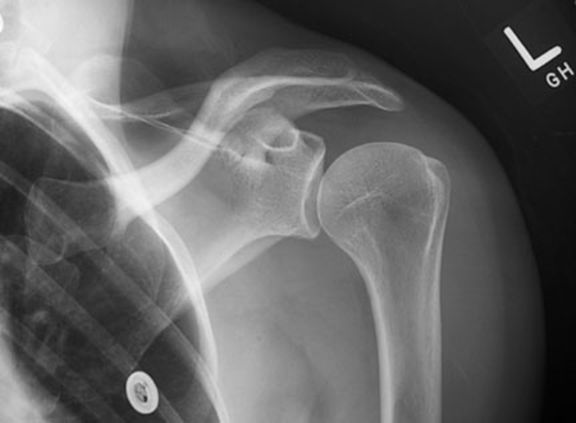 疼痛科怎么理疗疼痛科医生、康复理疗科医生、针刀针灸医生应掌握的常见骨科疾病X光片_https://www.jmylbn.com_新闻资讯_第1张