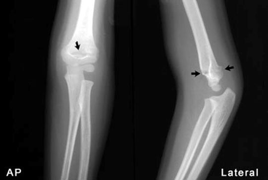 疼痛科怎么理疗疼痛科医生、康复理疗科医生、针刀针灸医生应掌握的常见骨科疾病X光片_https://www.jmylbn.com_新闻资讯_第12张
