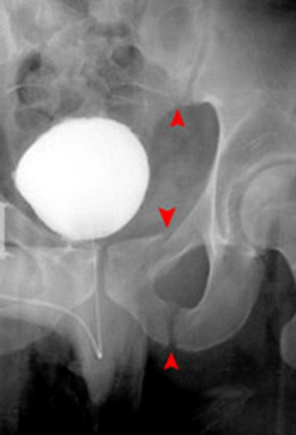39种常见骨科疾病的X线表现，看你认识几种？