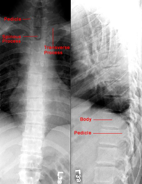 疼痛科怎么理疗疼痛科医生、康复理疗科医生、针刀针灸医生应掌握的常见骨科疾病X光片_https://www.jmylbn.com_新闻资讯_第55张