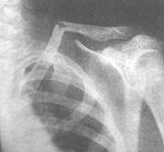 疼痛科怎么理疗疼痛科医生、康复理疗科医生、针刀针灸医生应掌握的常见骨科疾病X光片_https://www.jmylbn.com_新闻资讯_第3张