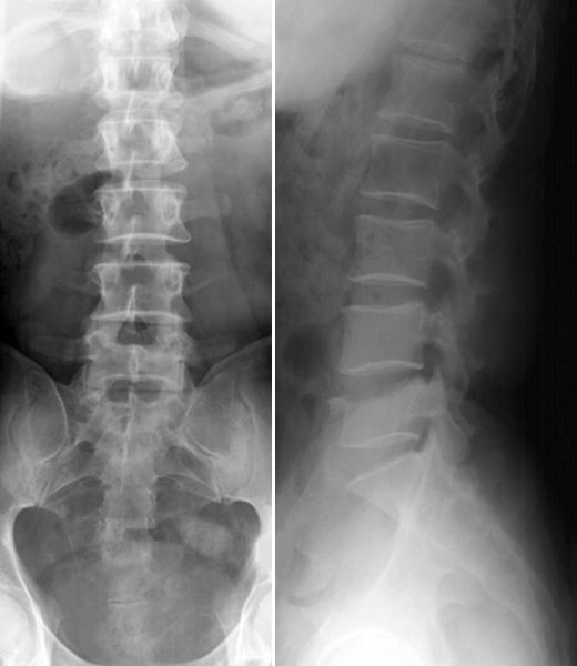 疼痛科怎么理疗疼痛科医生、康复理疗科医生、针刀针灸医生应掌握的常见骨科疾病X光片_https://www.jmylbn.com_新闻资讯_第58张
