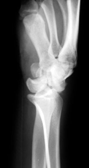 39种常见骨科疾病的X线表现，看你认识几种？