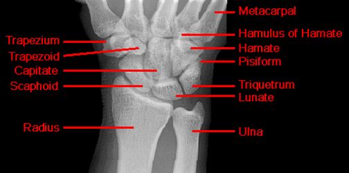 疼痛科怎么理疗疼痛科医生、康复理疗科医生、针刀针灸医生应掌握的常见骨科疾病X光片_https://www.jmylbn.com_新闻资讯_第23张