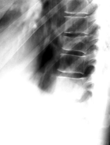 39种常见骨科疾病的X线表现，看你认识几种？