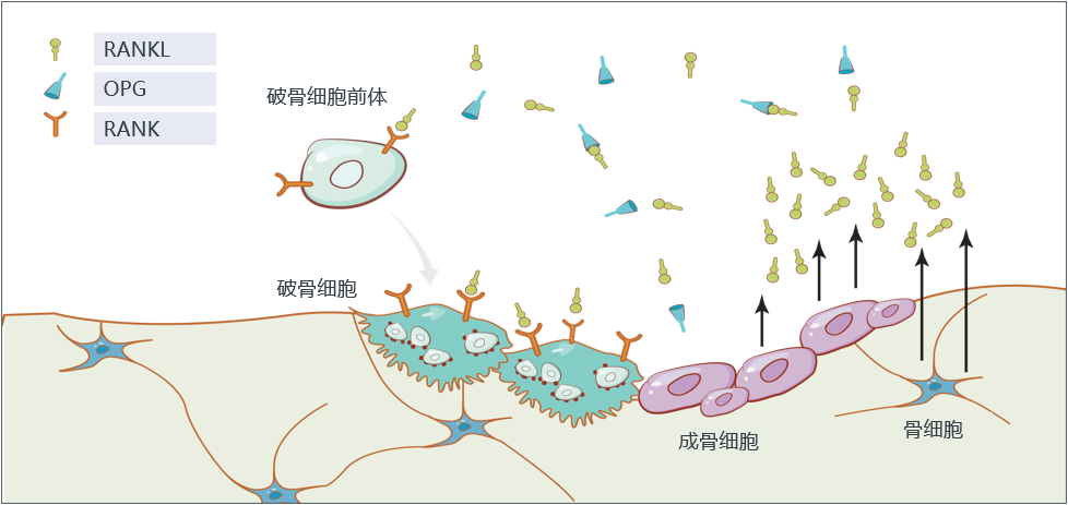 而骨转移的肿瘤细胞会加强破骨的过程,形成恶性循环