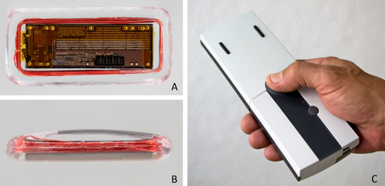 眼突计怎么用【惟视资讯】眼睛里植入一枚小芯片，术后不用跑医院，患者在家就能实现“测眼压自由”！准确性堪比“金标准”压平眼压计！_https://www.jmylbn.com_新闻资讯_第1张