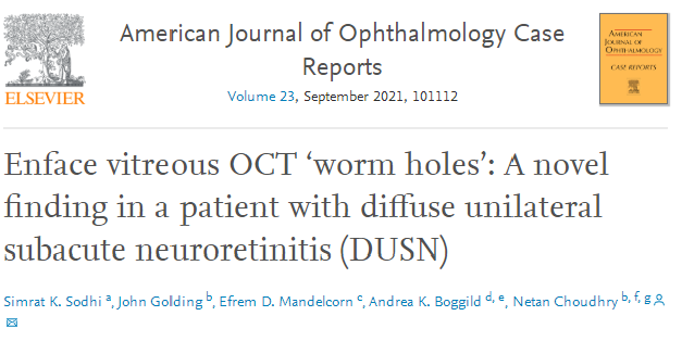 彩色眼底照相查什么【惟视诊室】炫彩眼底照相和Enface OCT让“虫洞”无所遁形_https://www.jmylbn.com_新闻资讯_第6张