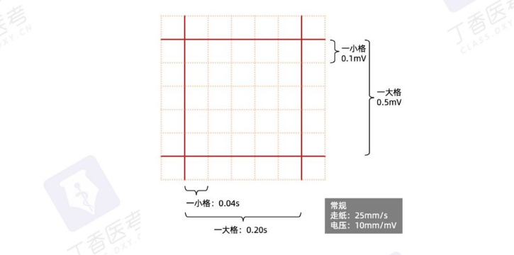 心电图纸怎么看考前突击：0 基础搞定心电图判读，看这一篇足够_https://www.jmylbn.com_新闻资讯_第3张