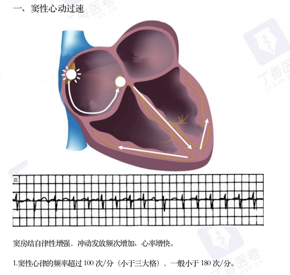 心电图纸怎么看考前突击：0 基础搞定心电图判读，看这一篇足够_https://www.jmylbn.com_新闻资讯_第5张
