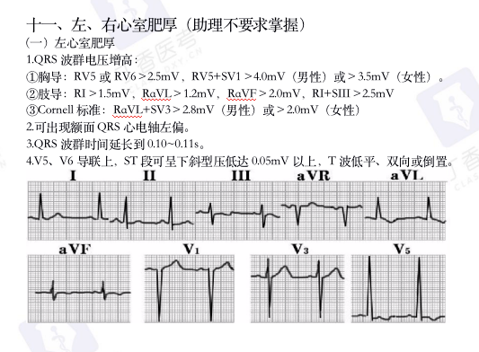 心电图纸怎么看考前突击：0 基础搞定心电图判读，看这一篇足够_https://www.jmylbn.com_新闻资讯_第18张