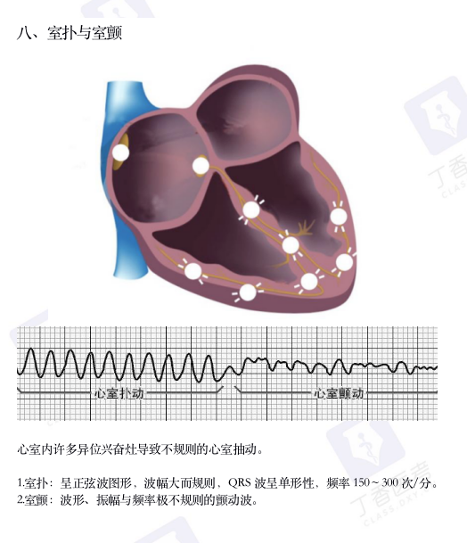 心电图纸怎么看考前突击：0 基础搞定心电图判读，看这一篇足够_https://www.jmylbn.com_新闻资讯_第12张